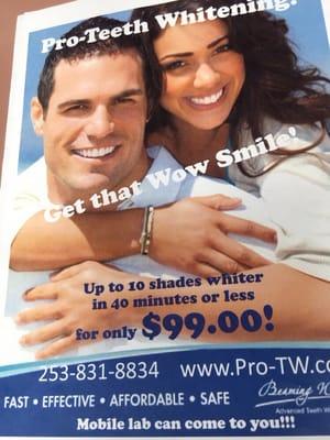 Teeth whitening at our office is only 99.00