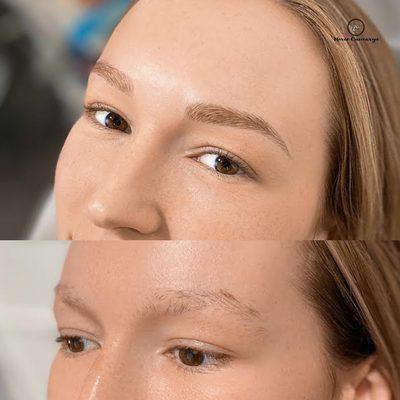 Nano-Microblading