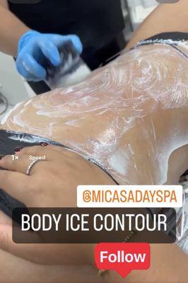 Ice contouring