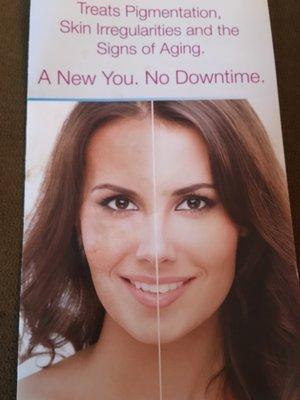 Picoway laser Resolve skin rejuvenation