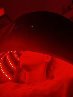 LED lights they put on after to help calm the skin down after micro needling