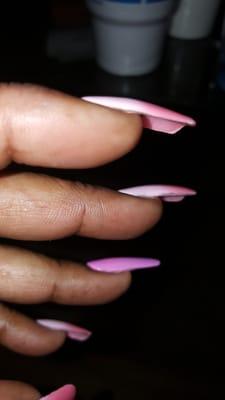 My edges of my nails on one side, are so straight worth no definition