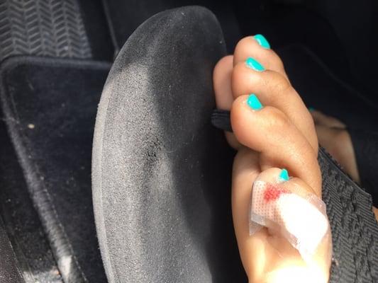 Cut on my foot from careless mistake by nail tech with pedicure supplies.