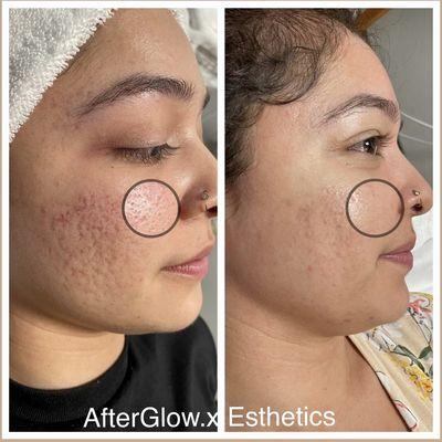 After Glow Esthetics