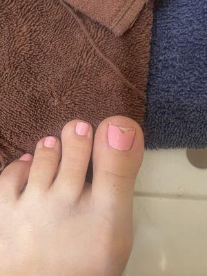 Also, my toe chipped  two days ago