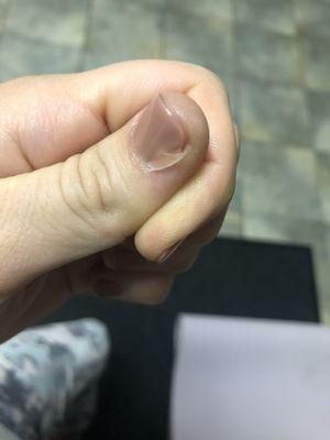 Gel fused to skin, lifted polish completely off my nail bed