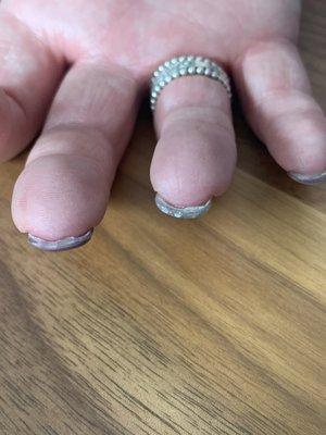 Acrylic under nails that's not supposed to there