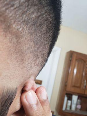 Right about ear, patch of almost bald