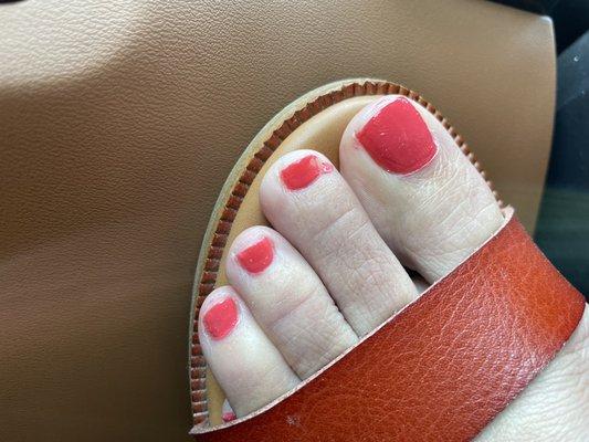 Terrible pedicure