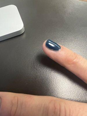 Uneven polish crooked on skin