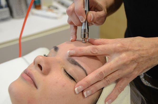 Microdermabrasion polishes the skin and removes redundant dead skin cell build up.