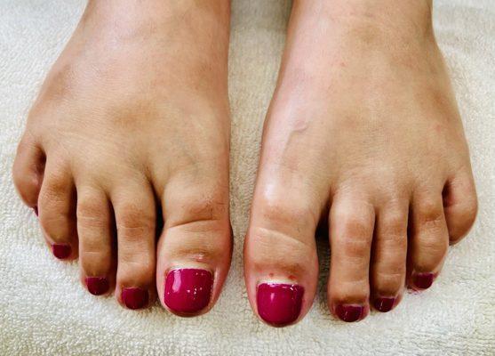 Pretty..! Gel pedicure..!