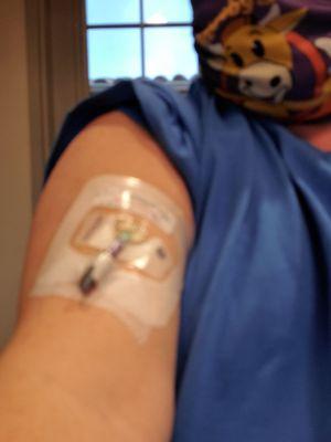 This is the picc line that was inserted prior to the endoscopy, so they didn't have to keep poking you for the additional appointments.