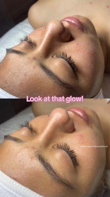 Eyelash Lift