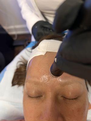 Hydrafacial