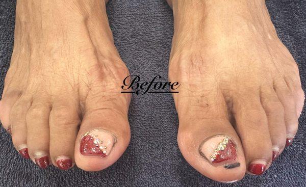 Client came in with a gel pedicure done in Mexico, products used: unknown.