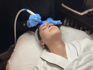 Hydradermabrasion Treatment