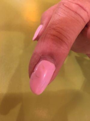 Broken nail after one week.