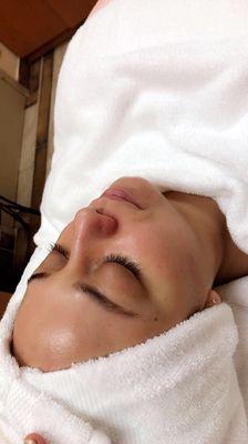 Beautiful skin starts with a facial, after microdermabrasion & pumpkin Enzyme .