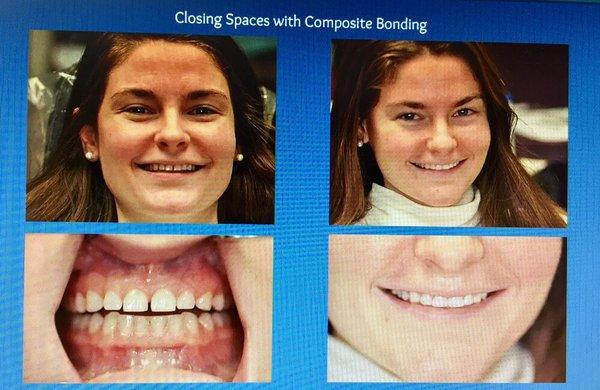 Fantastic Smile Makeover