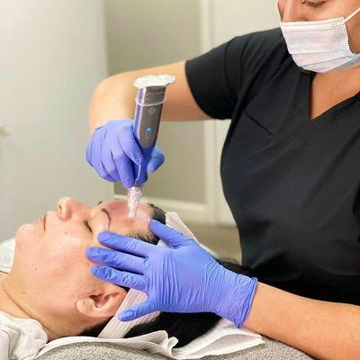 SkinPen Microneedling device in use