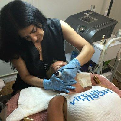 Microneedling Treatment