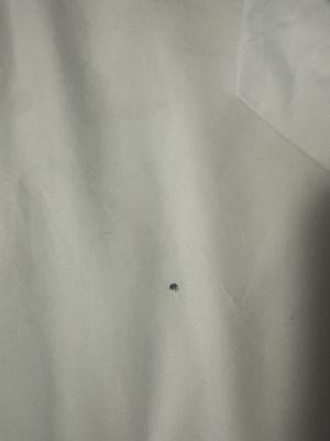 Bed bug I killed after waking up with bites all over body