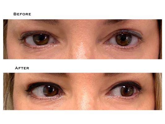 Clients eyeliner was old, faded and uneven. We darkened and perfected her Permanent Eyeliner.