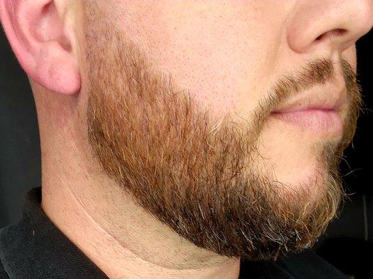 Beard trim