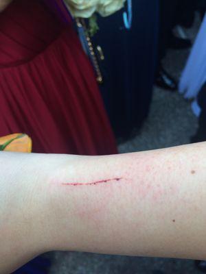 corsage made a HUGE gash at prom!