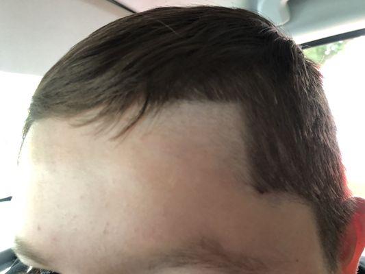 Left side of forehead