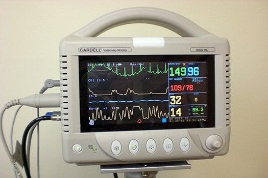 Anesthetic monitor