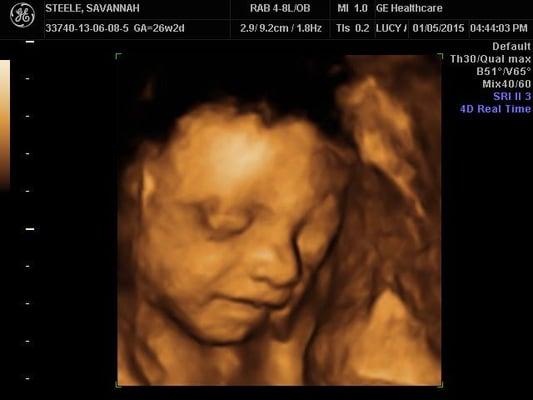 Beautiful and clear picture of our little girl smiling at 26 weeks! She already adores Lucy!