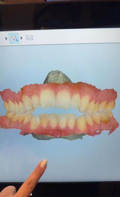 This is the scanner that shows all your teeth!!! Super cool!