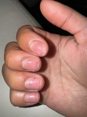 crack nails, cuts in nails, fingernail cut in half