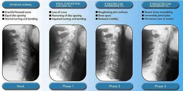 Keep joints functioning as you get older.