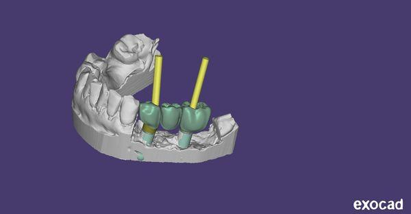 Elite Dental Studio 
 Dental LAboratory Laboratory 
 #Dental LAb, #Dental Laboratory, 2445 Hilton Drive, Suite 100B, gainesville, Ga 30501,