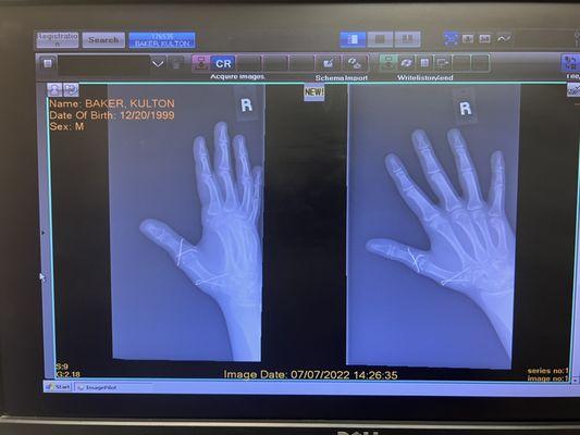 Hand Surgery Specialists of Texas