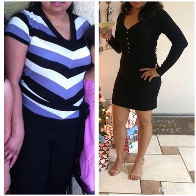 Current patient with successful weight loss!  Our program works!  Join today!