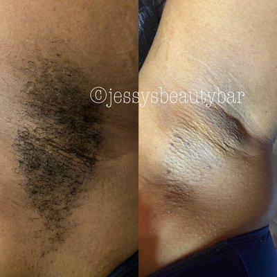 Underarm wax