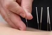 needling