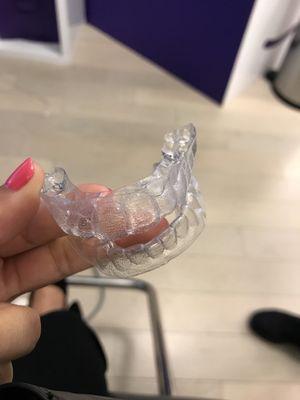 What the aligners will look like