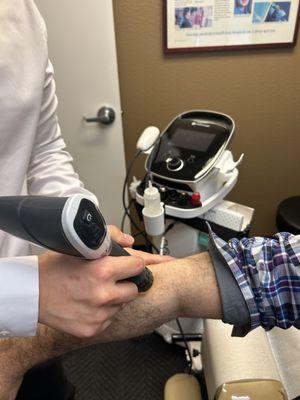 Shockwave Therapy on Elbow