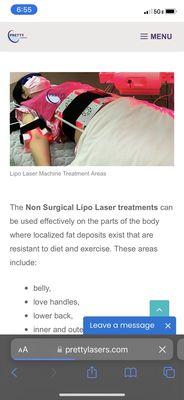 This is what a laser Lipo treatment is supposed to look like.