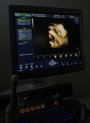 3D/4D Ultrasounds to Fulfill the Experience.