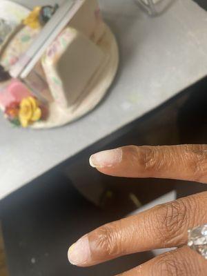 Nails damaged beyond belief