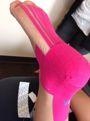 KT taping for an ankle injury