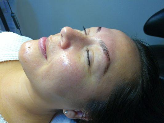 Client after a facial that included dermaplaning and an enzyme treatment, along with a brow tint and lamination!