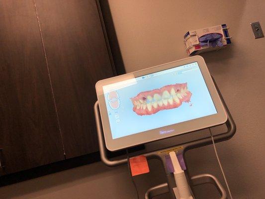 3D scan of my teeth after Dr.kadawani work. They charged me $5000 for this.