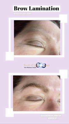 Brow Lamination